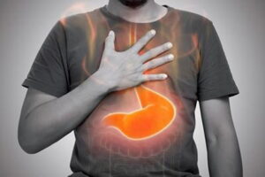 How Do I Deal With Acid Reflux?