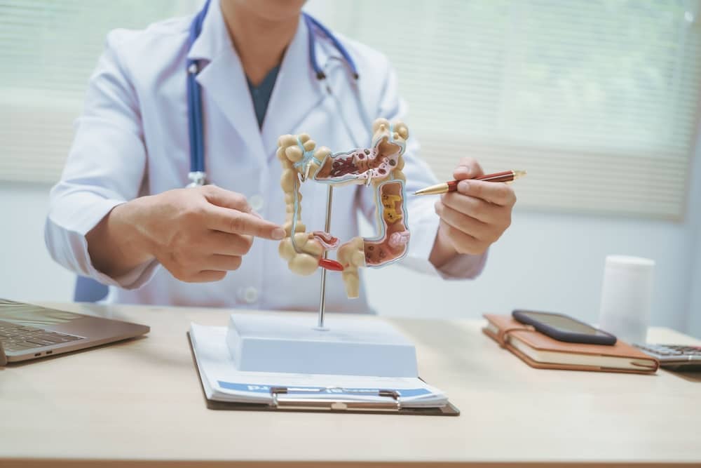 Understanding-diverticulosis