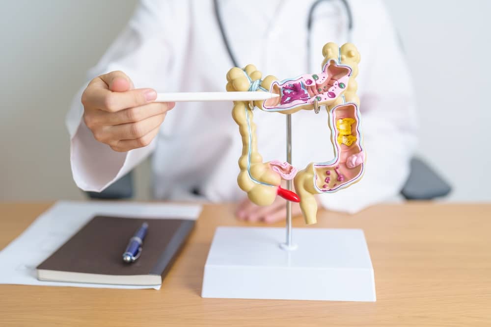 Understanding-ulceratice Colitis